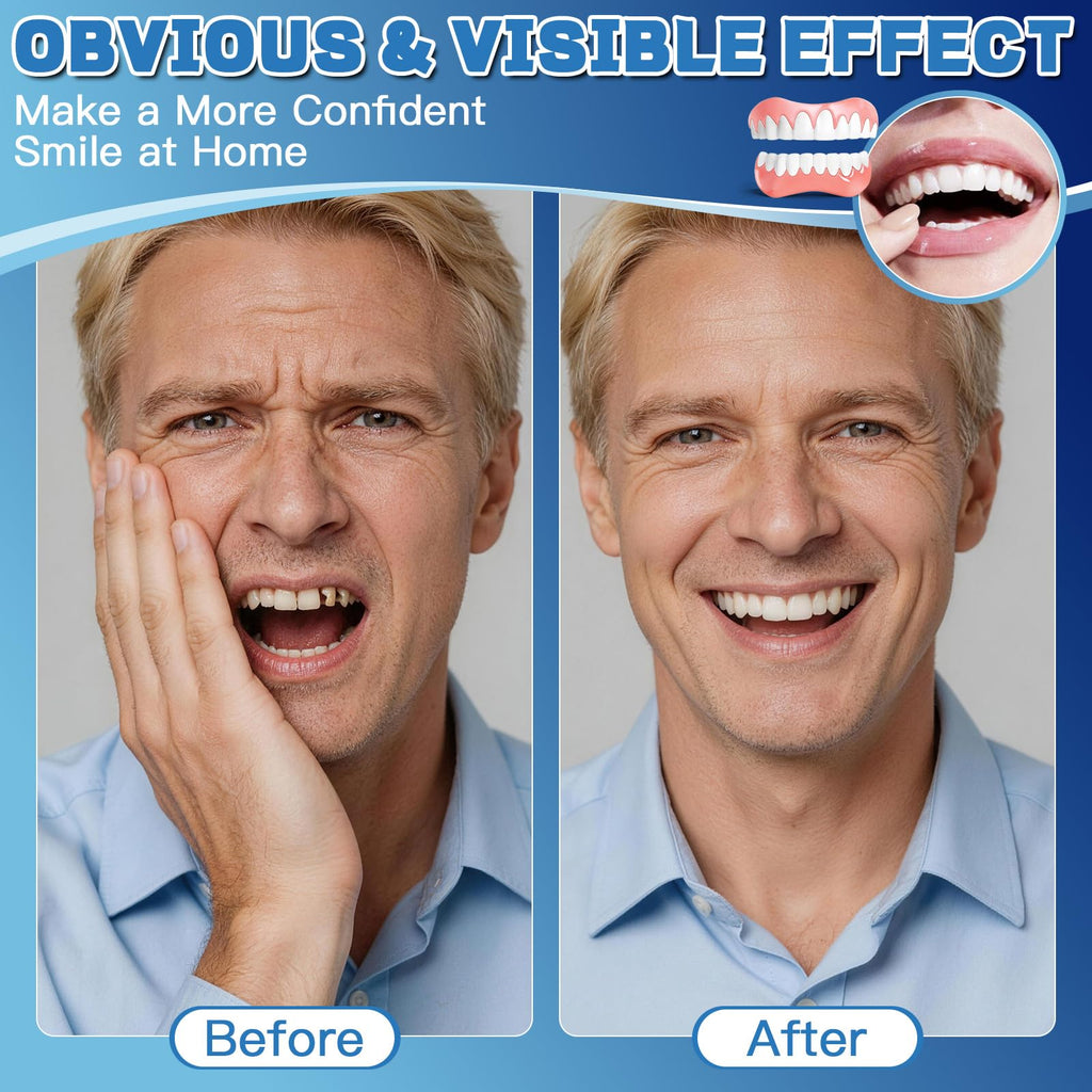 Moldable False Teeth Dentures Set with Dental Adhesive Beads W37275